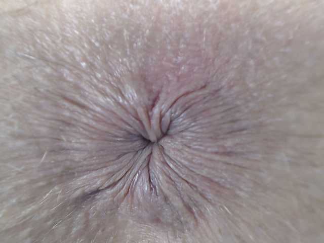 广播屏幕截图 crazyvaginal