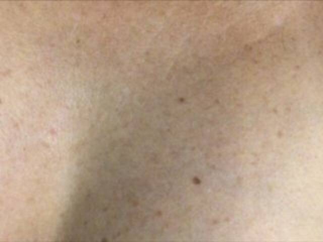 广播屏幕截图 Alianakiss