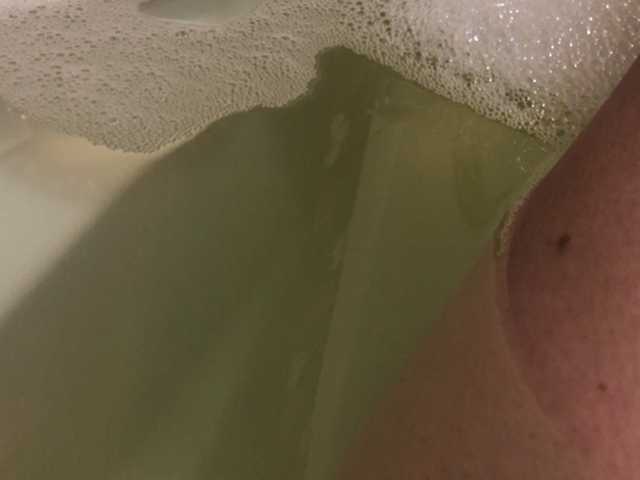 广播屏幕截图 Alianakiss