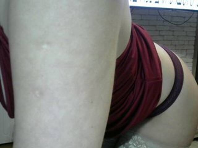 广播屏幕截图 CHERRYjuice