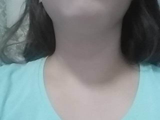 广播屏幕截图 cherry-cake