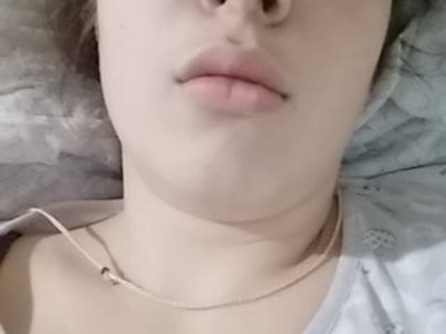 广播屏幕截图 cherry-cake