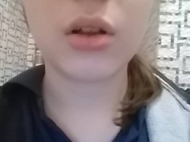 广播屏幕截图 cherry-cake