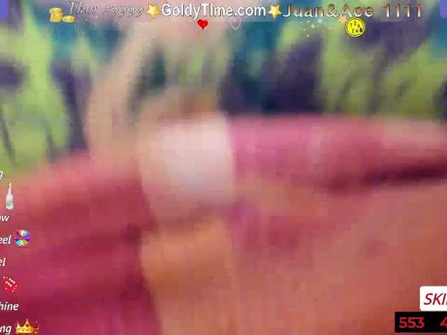 广播屏幕截图 GoldyXO