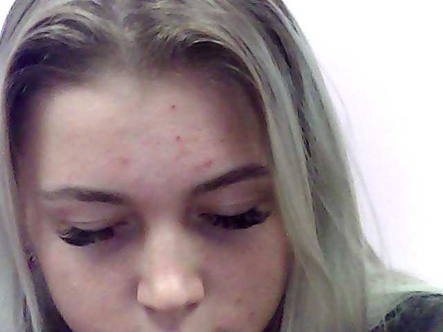 广播屏幕截图 PatHakeza