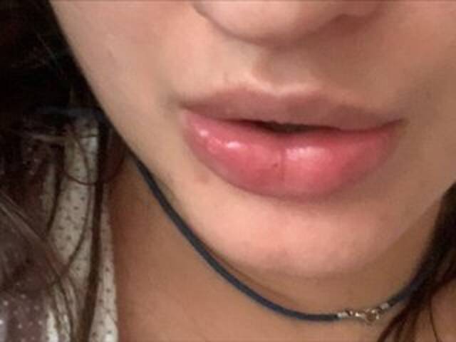 广播屏幕截图 Rinaru555555