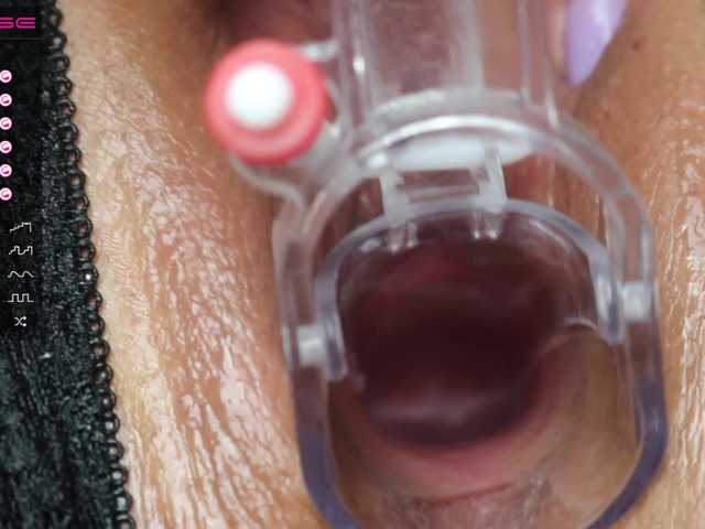 广播屏幕截图 StellaFlurry